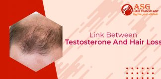 Link Between Testosterone And Hair Loss