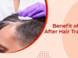 Benefit of PRP After Hair Transplant