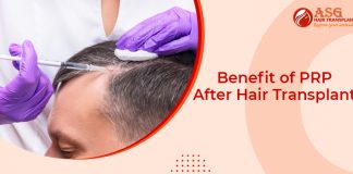 Benefit of PRP After Hair Transplant