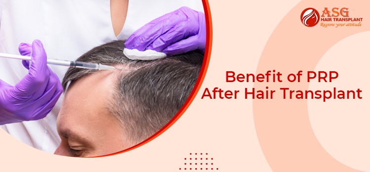 The Benefits of PRP Treatment and Hair Transplant for hair loss — skin and  hair care | by Bonitaacliinic | Medium