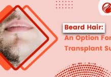 Advantages and disadvantages of Beard to Scalp FUE Hair Transplant