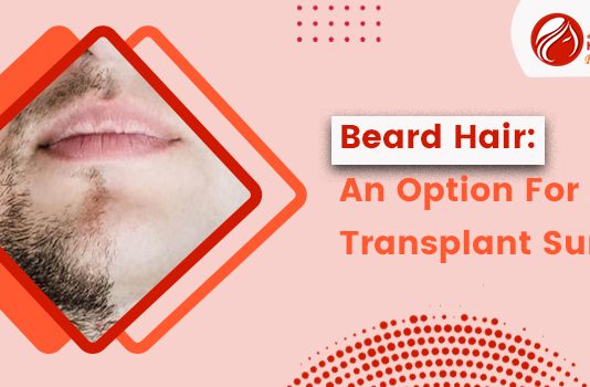 Beard Hair An Option For Hair Transplant Surgery