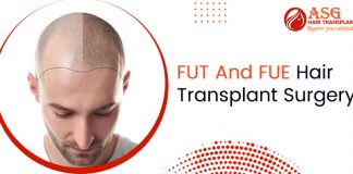 FUT And FUE Hair Transplant Surgery