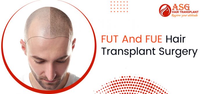 FUT And FUE Hair Transplant Surgery