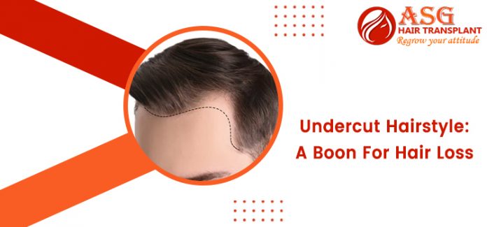 Undercut Hairstyle A Boon For Hair Loss
