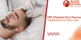 PRP (Platelet Rich Plasma) Treatment For Hair Loss