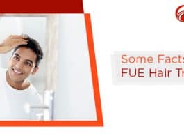 Some Facts About FUE Hair Transplant