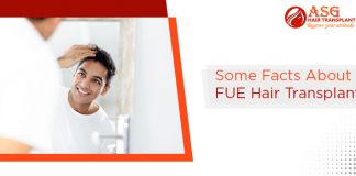 Some Facts About FUE Hair Transplant