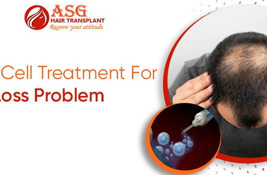 Stem Cell Treatment For Hair Loss Problem ASG HAIRTRANSPLANT