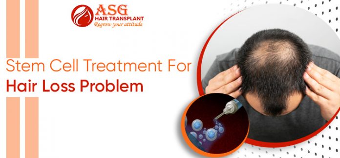 Stem Cell Treatment For Hair Loss Problem ASG HAIRTRANSPLANT