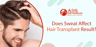 Does Sweat Affect Hair Transplant Result?