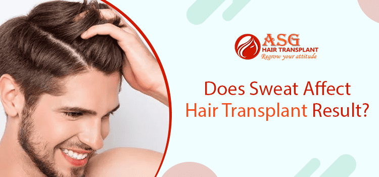 Effect Of Sweat Post Hair Transplant Surgery And How To Prevent Them