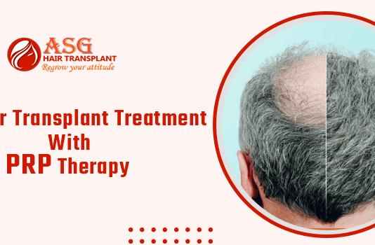 FUE Hair Transplant Treatment With PRP Therapy
