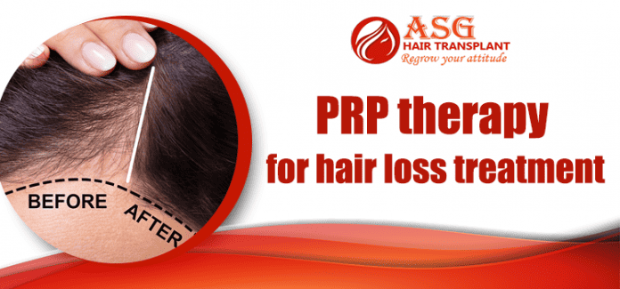 PRP therapy for hair loss treatment