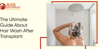 The Ultimate Guide About Hair Wash After Transplant