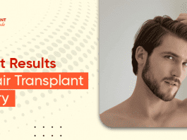 get Best Results After Hair Transplant Recovery