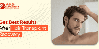 get Best Results After Hair Transplant Recovery