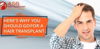 Here’s-Why-You-Should-Go-For-A-Hair-Transplant