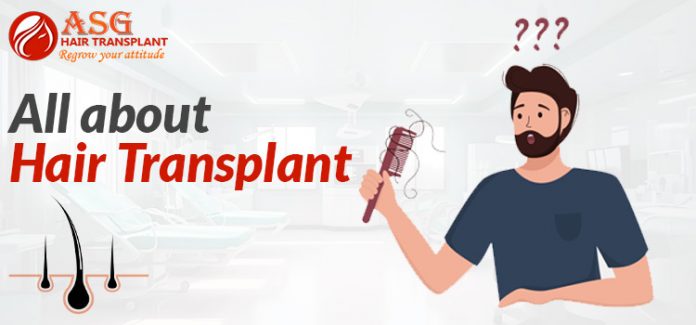 All about hair transplant
