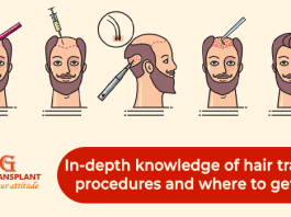 In-depth knowledge of hair transplant procedures and where to get them.