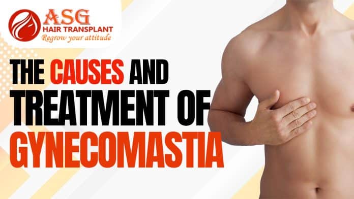 The causes and treatment of Gynecomastia