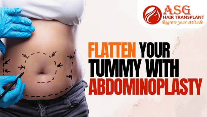 What Is Abdominoplasty And Its Cost?