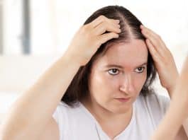 What are some common hair problems?