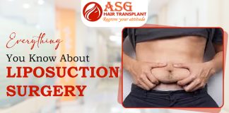 Everything You Know About Liposuction Surgery