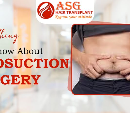 Everything You Know About Liposuction Surgery