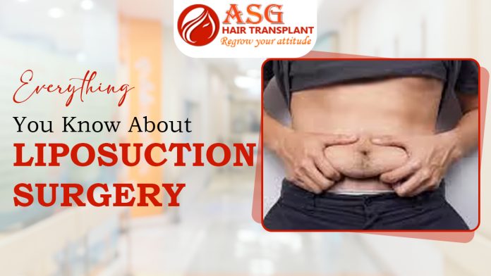 Everything You Know About Liposuction Surgery