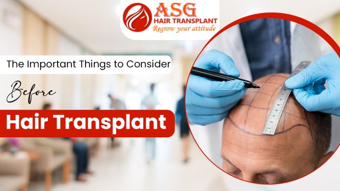 The Important Things to Consider Before Hair Transplant