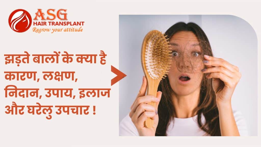 झड़ते बालों के क्या है कारण, लक्षण, निदान, उपाय, इलाज और घरेलु उपचार !