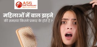 महिलाओं में बाल झड़ने की समस्या कितने प्रकार के होते है ?