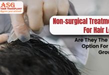 Non-surgical Treatments For Hair Loss: Are They The Best Option For Hair Growth?