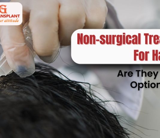 Non-surgical Treatments For Hair Loss: Are They The Best Option For Hair Growth?