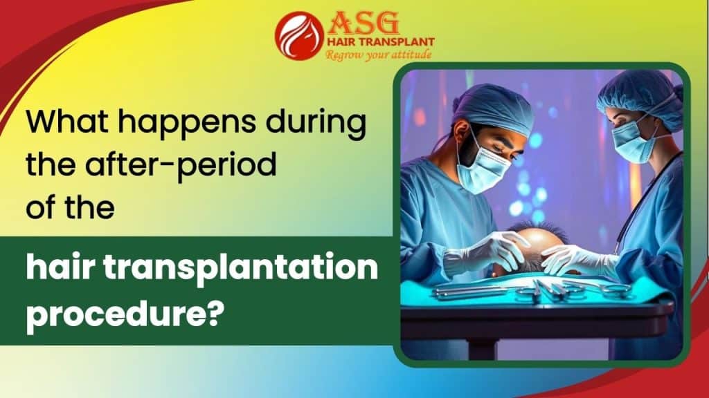 After-Hair Transplant Recovery: Key Stages and What to Expect