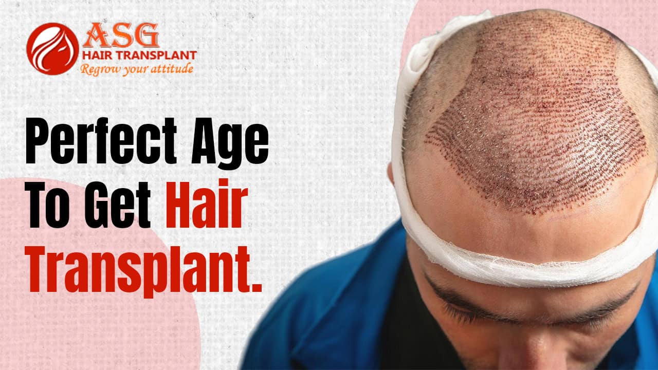 Perfect Age for a Hair Transplant: Know When It’s Right for You