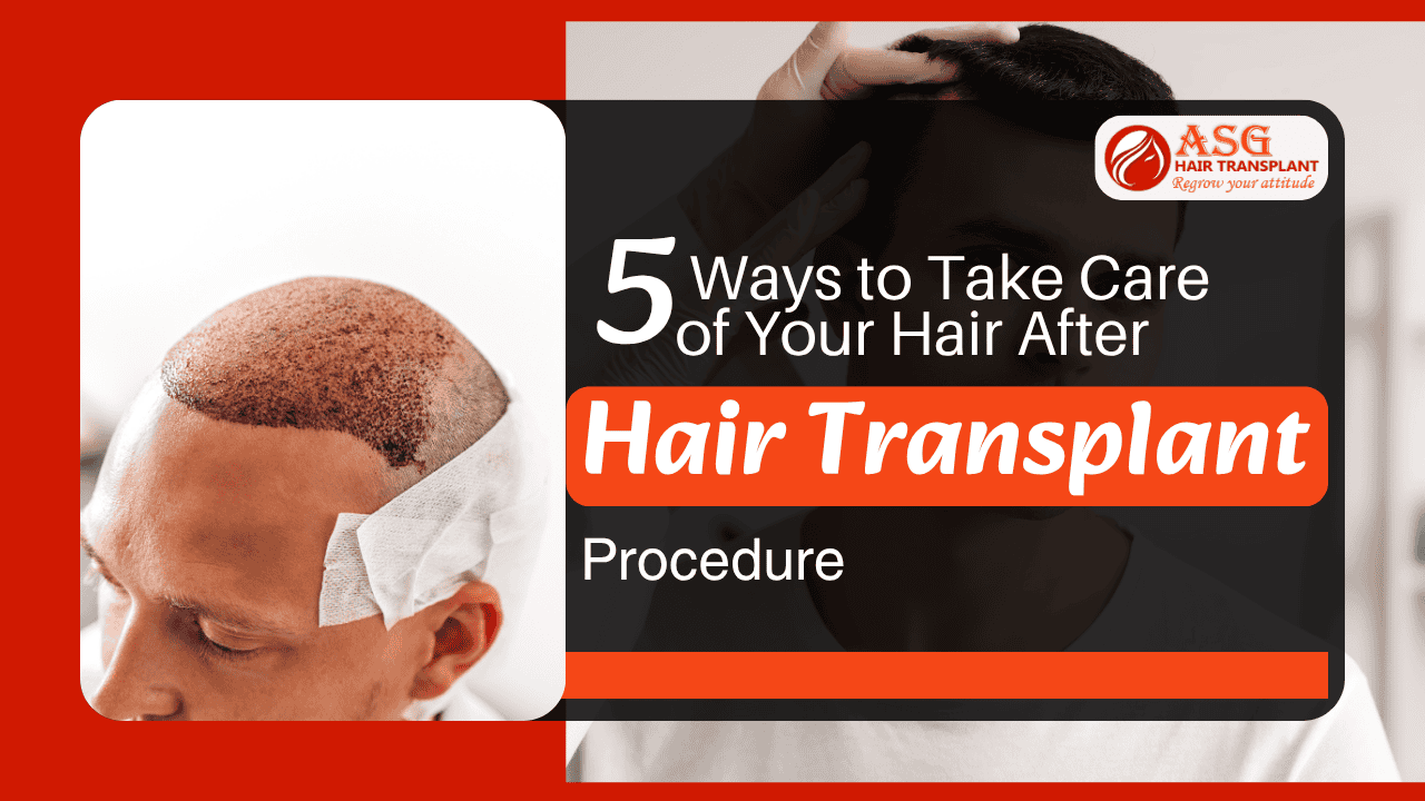 5 Ways to Take Care of Your Hair After Hair Transplant Procedure